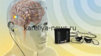 Нейростимуляция мозга: прорывные методы восстановления когнитивных функций в 2026 году