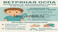 Карелия в 2026 году: лидер по заболеваемости ветряной оспой — причины и меры профилактики
